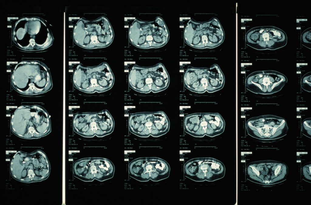 CT scan viewers online