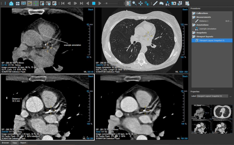 DICOM viewer free online